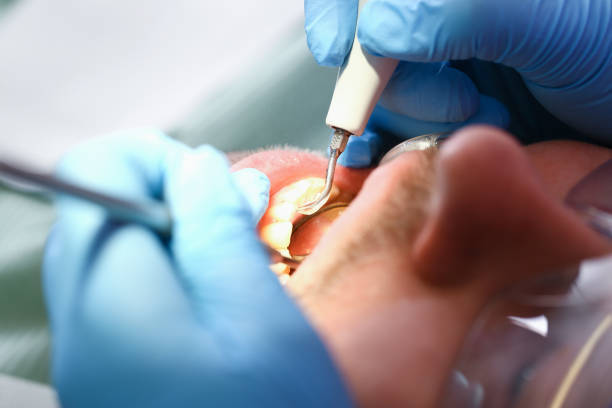 Best Emergency Dentist for Knocked-Out Tooth in North Haledon, NJ